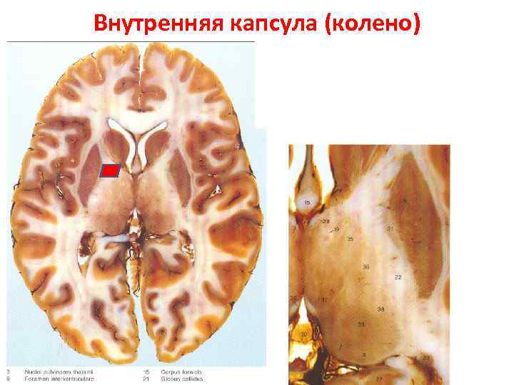 Bнутренняя капсула (колено) 