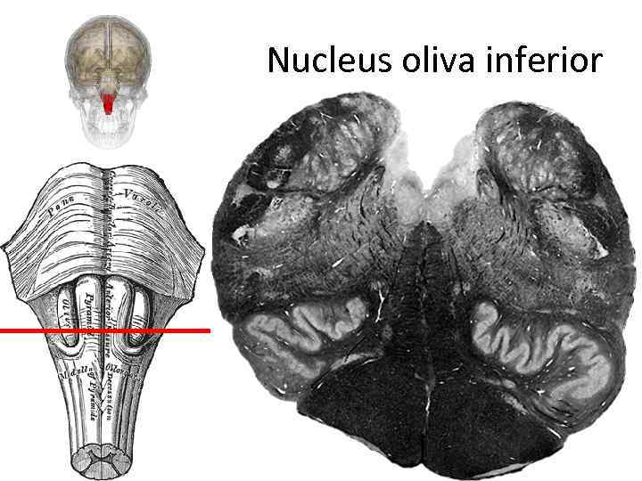 Nucleus oliva inferior 