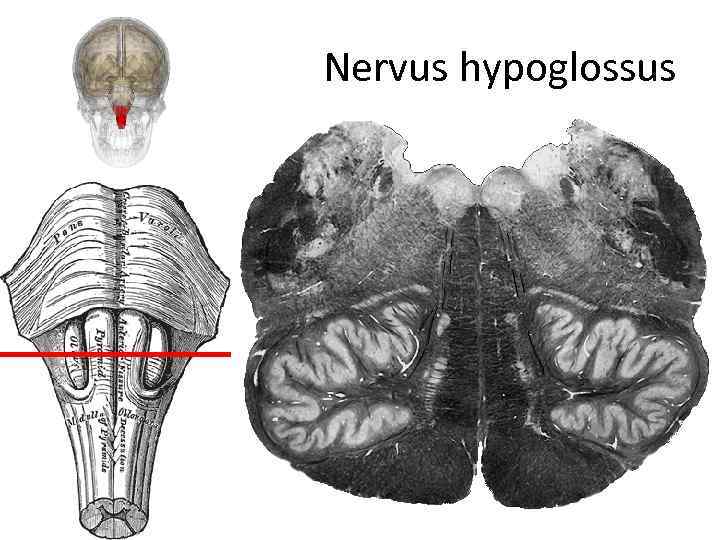 Nervus hypoglossus 