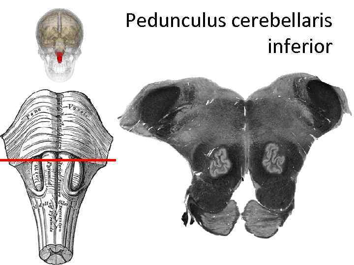 Pedunculus cerebellaris inferior 