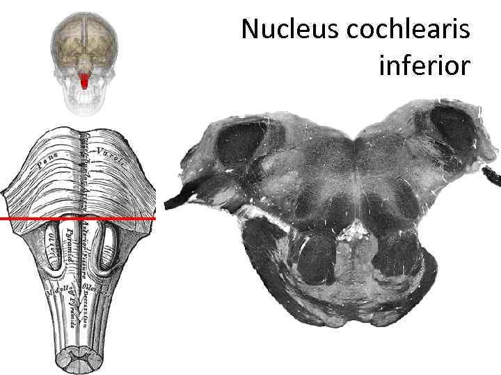 Nucleus cochlearis inferior 