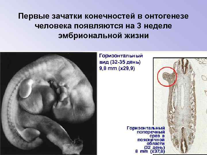 Первые зачатки конечностей в онтогенезе человека появляются на 3 неделе эмбриональной жизни Горизонтальный вид
