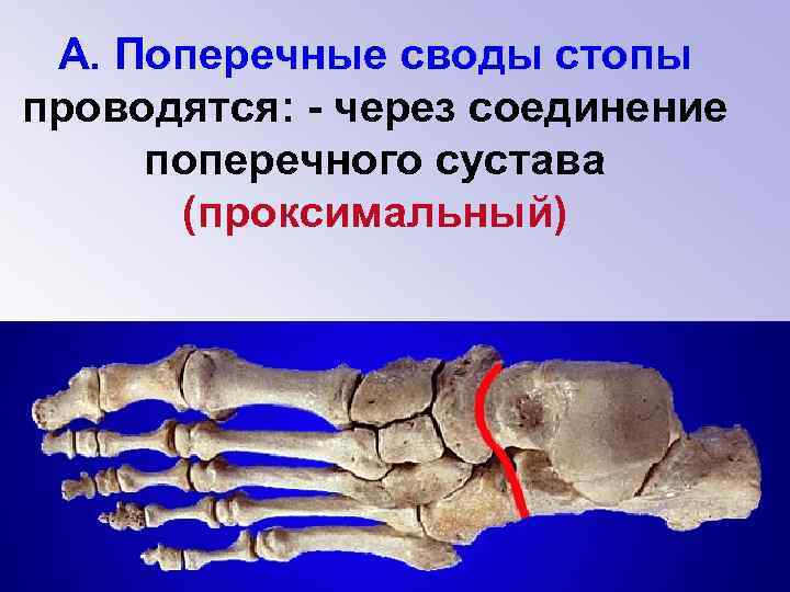 А. Поперечные своды стопы проводятся: - через соединение поперечного сустава (проксимальный) 