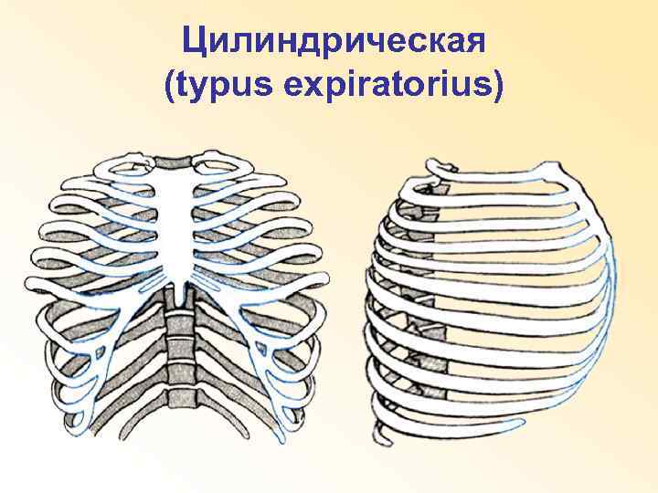 Цилиндрическая (typus expiratorius) 