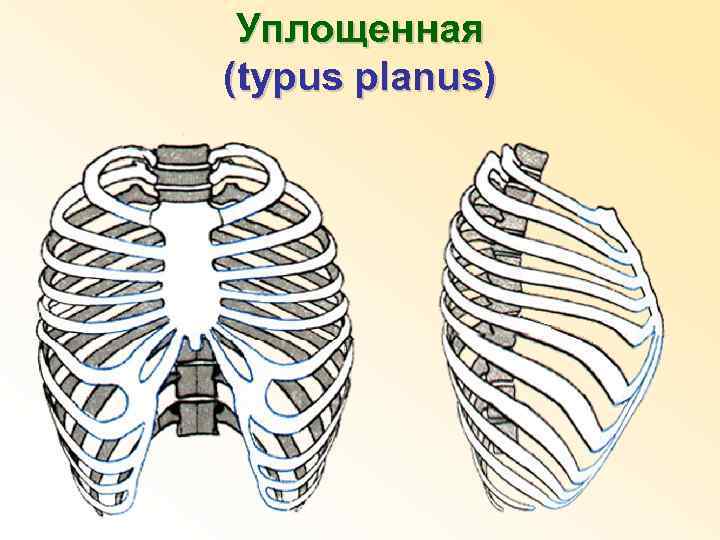 Уплощенная (typus planus) 