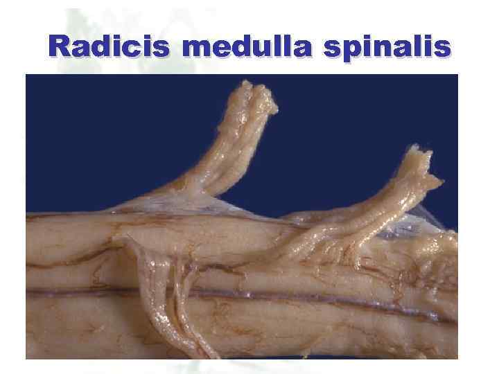 Radicis medulla spinalis 