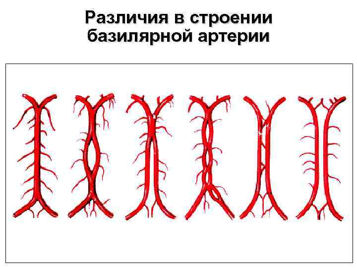 Ветви базилярной артерии схема