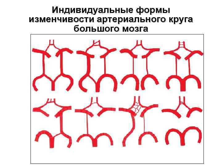 Индивидуальные формы изменчивости артериального круга большого мозга 