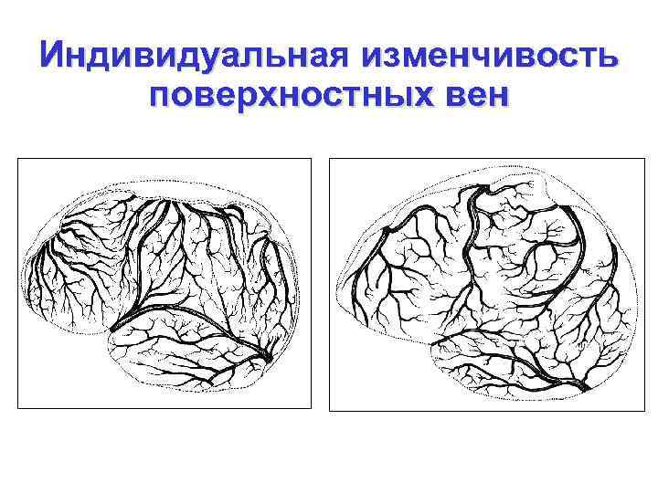 Индивидуальная изменчивость поверхностных вен 