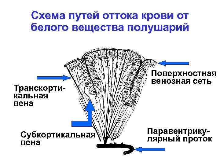 Схема оттока внутриглазной жидкости