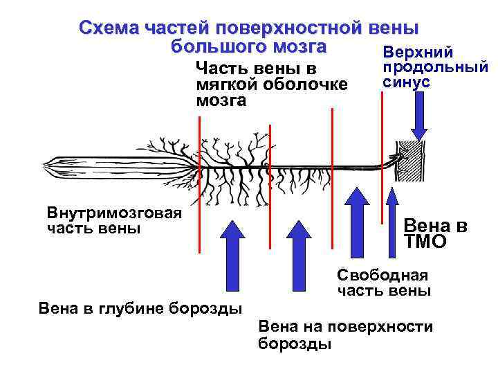 Схема частей поверхностной вены большого мозга Верхний Часть вены в мягкой оболочке мозга Внутримозговая