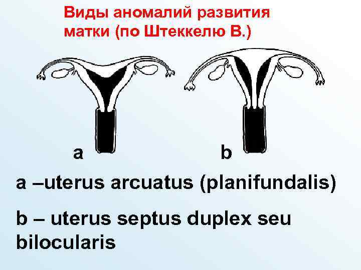 Аномалии развития матки. Протокол аномалии развития матки.
