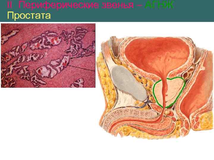 II Периферические звенья – АГНЖ Простата 
