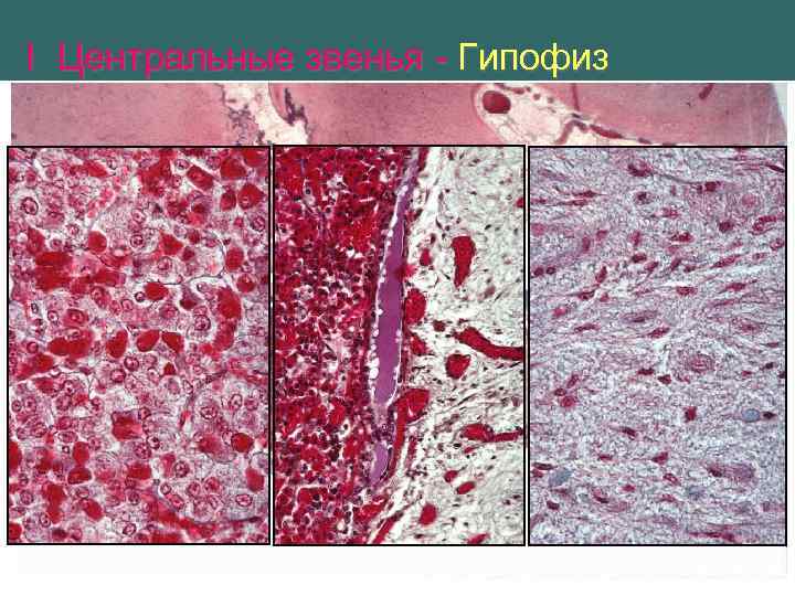 I Центральные звенья - Гипофиз 