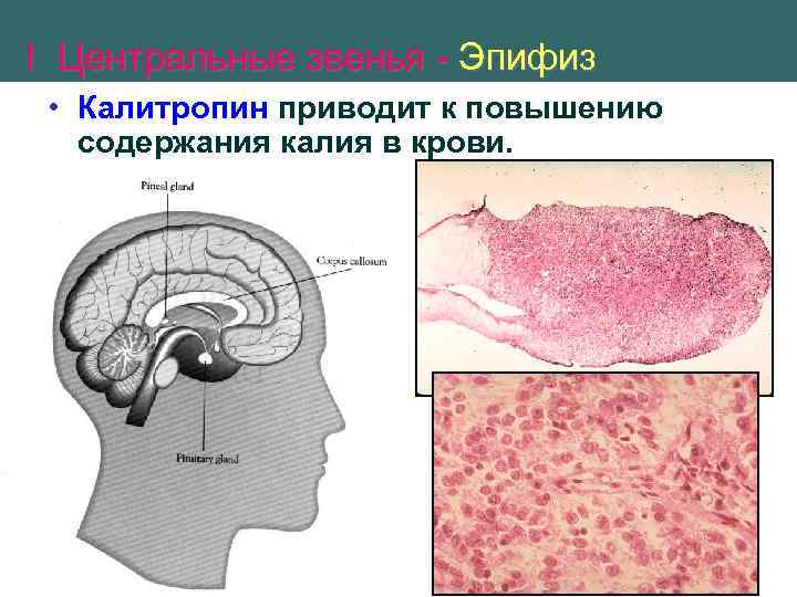 Функции эпифиза. Гормоны эпифиза. Эпифиз гормоны и функции. Калитропин. Функции гипофиза и эпифиза таблица.