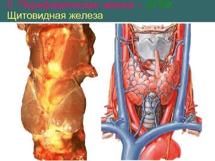 II Периферические звенья – АГЗЖ Щитовидная железа 