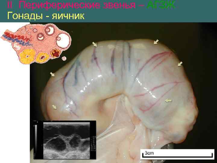 II Периферические звенья – АГЗЖ Гонады - яичник 