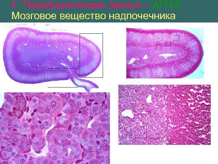 II Периферические звенья – АГНЖ Мозговое вещество надпочечника 