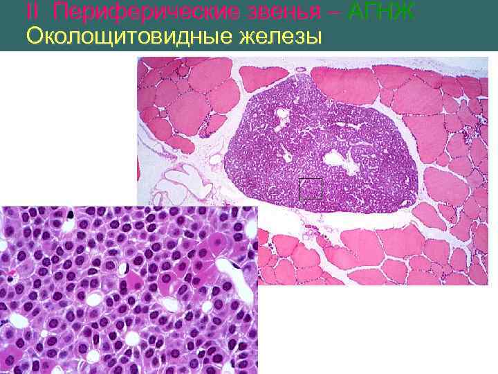 II Периферические звенья – АГНЖ Околощитовидные железы 