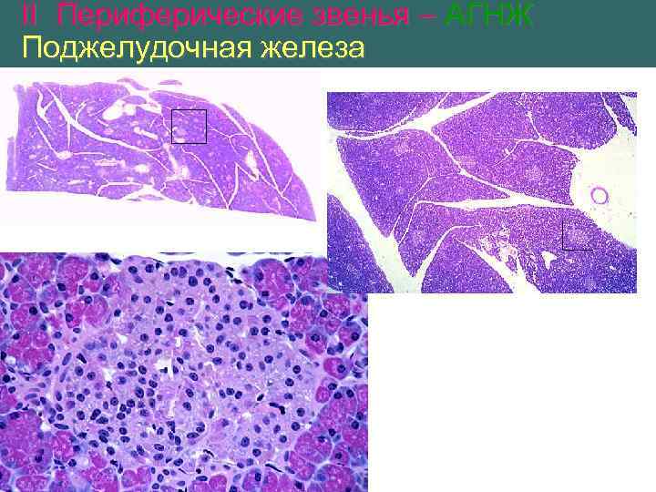 II Периферические звенья – АГНЖ Поджелудочная железа 