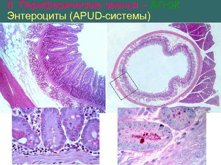 II Периферические звенья – АГНЖ Энтероциты (APUD-системы) 