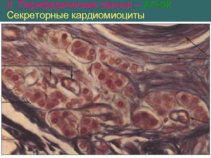 II Периферические звенья – АГНЖ Секреторные кардиомиоциты 