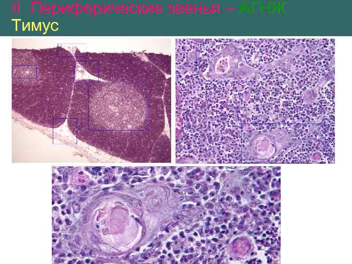 II Периферические звенья – АГНЖ Тимус 