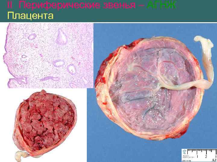 II Периферические звенья – АГНЖ Плацента 