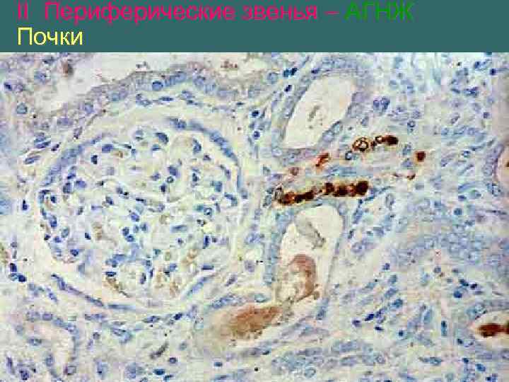 II Периферические звенья – АГНЖ Почки 