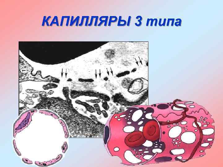 КАПИЛЛЯРЫ 3 типа 