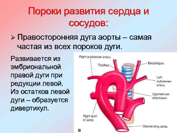 Варианты дуги аорты