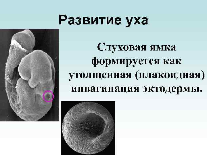 Развитие уха Слуховая ямка формируется как утолщенная (плакоидная) инвагинация эктодермы. 