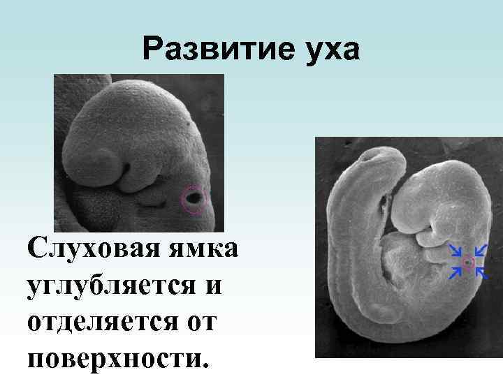 Зародыш ухо. Формирование уха у эмбриона. Эмбриональное развитие уха.