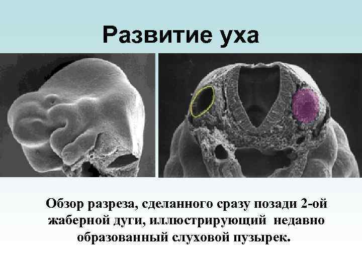 Развитие уха Обзор разреза, сделанного сразу позади 2 -ой жаберной дуги, иллюстрирующий недавно образованный