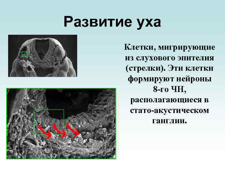 Развитие уха Клетки, мигрирующие из слухового эпителия (стрелки). Эти клетки формируют нейроны 8 -го