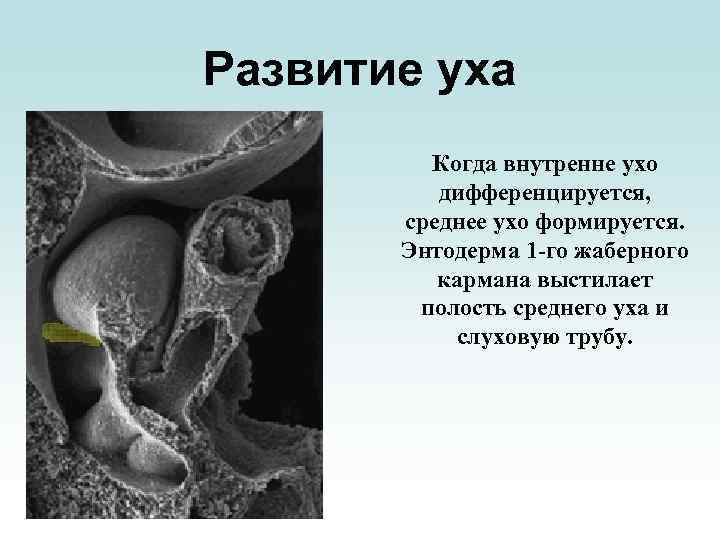 Развитие уха Когда внутренне ухо дифференцируется, среднее ухо формируется. Энтодерма 1 -го жаберного кармана