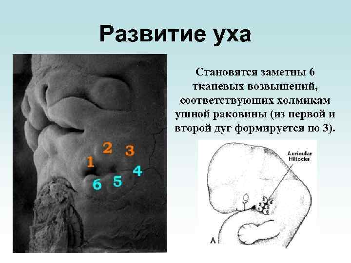 Развитие уха Становятся заметны 6 тканевых возвышений, соответствующих холмикам ушной раковины (из первой и