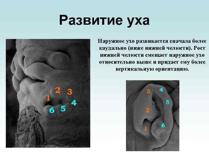 Развитие уха Наружное ухо развивается сначала более каудально (ниже нижней челюсти). Рост нижней челюсти
