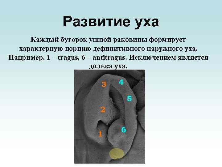 Развитие уха Каждый бугорок ушной раковины формирует характерную порцию дефинитивного наружного уха. Например, 1