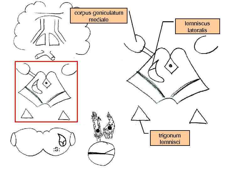 corpus geniculatum mediale lemniscus lateralis trigonum lemnisci : S: 