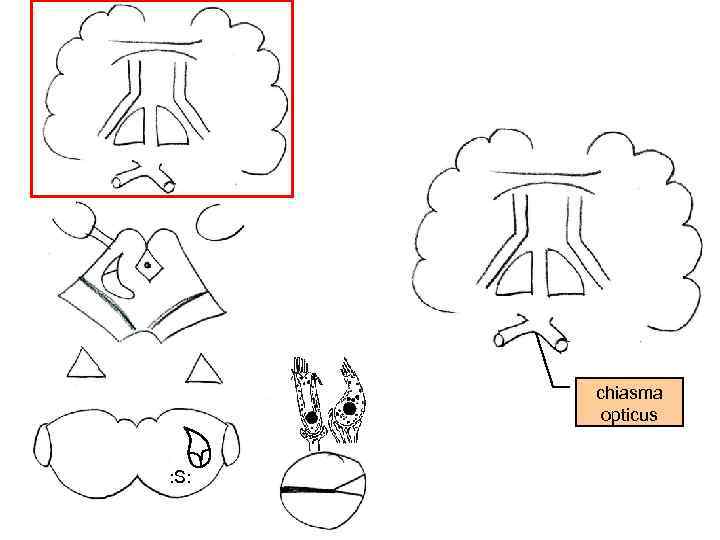 chiasma opticus : S: 