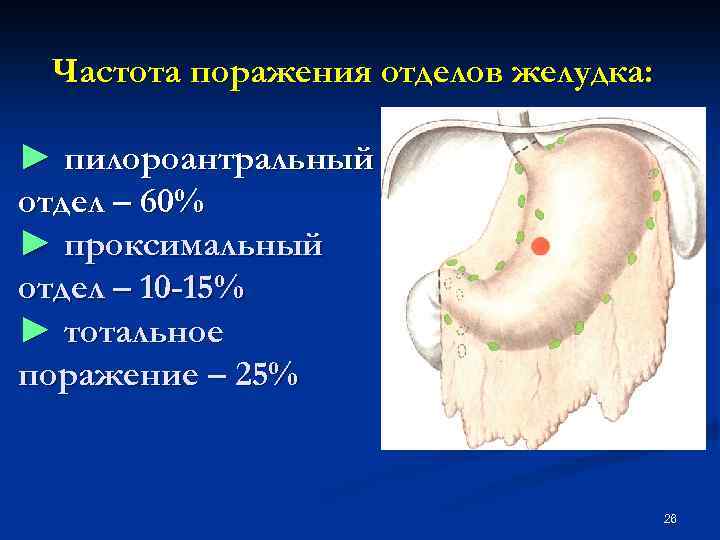 Частота поражения отделов желудка: ► пилороантральный отдел – 60% ► проксимальный отдел – 10