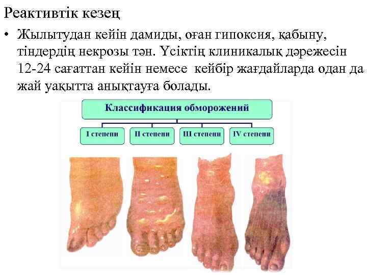 Реактивтік кезең • Жылытудан кейін дамиды, оған гипоксия, қабыну, тіндердің некрозы тән. Үсіктің клиникалық