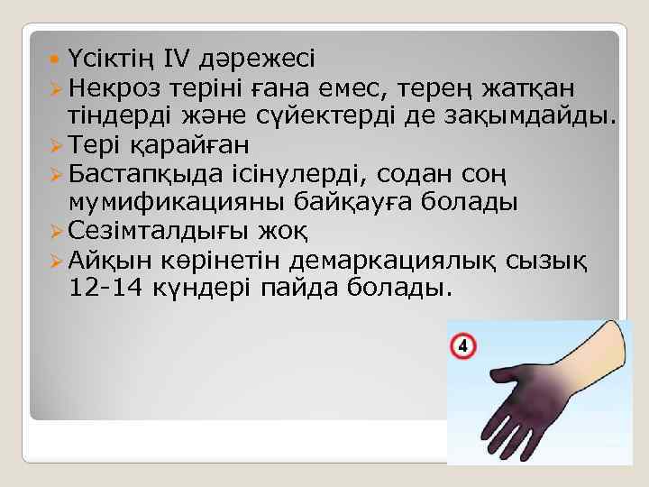  Үсіктің IV дәрежесі Ø Некроз теріні ғана емес, терең жатқан тіндерді және сүйектерді