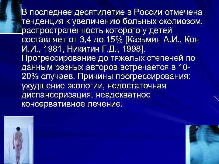 В последнее десятилетие в России отмечена тенденция к увеличению больных сколиозом, распространенность которого у