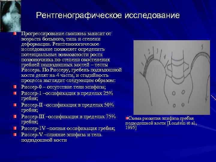 Рентгенографическое исследование Прогрессирование сколиоза зависит от возраста больного, типа и степени деформации. Рентгенологическое исследование