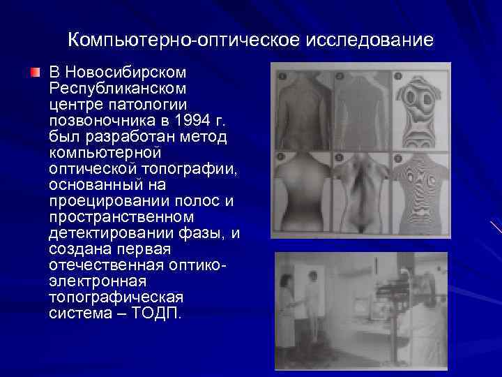 Компьютерно оптическое исследование В Новосибирском Республиканском центре патологии позвоночника в 1994 г. был разработан