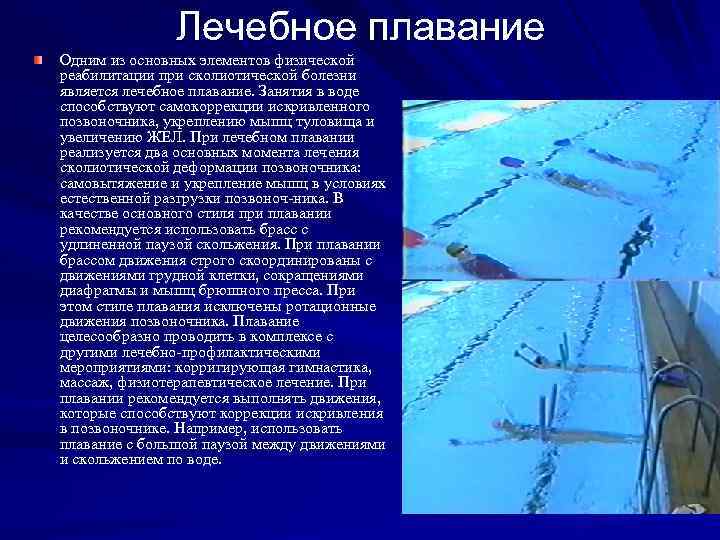 Лечебное плавание Одним из основных элементов физической реабилитации при сколиотической болезни является лечебное плавание.