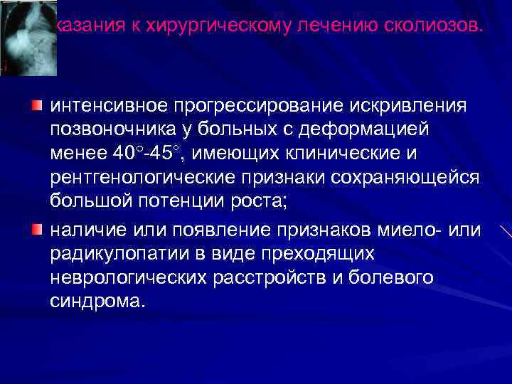 Показания к хирургическому лечению сколиозов. интенсивное прогрессирование искривления позвоночника у больных с деформацией менее