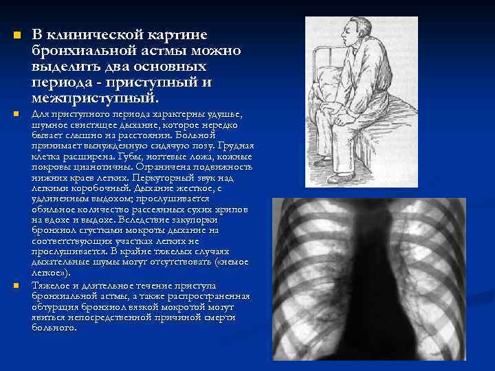 n n n В клинической картине бронхиальной астмы можно выделить два основных периода -